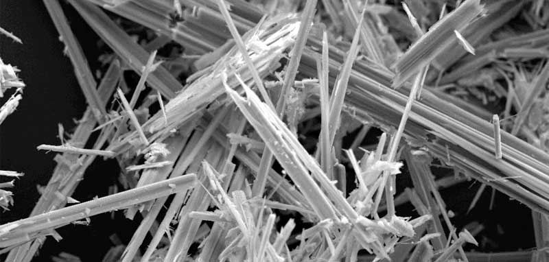 แร่ใยหิน Asbestos|โรคปอดอักเสบจาก แร่ใยหิน หรือ Asbestos|Asbestos Case